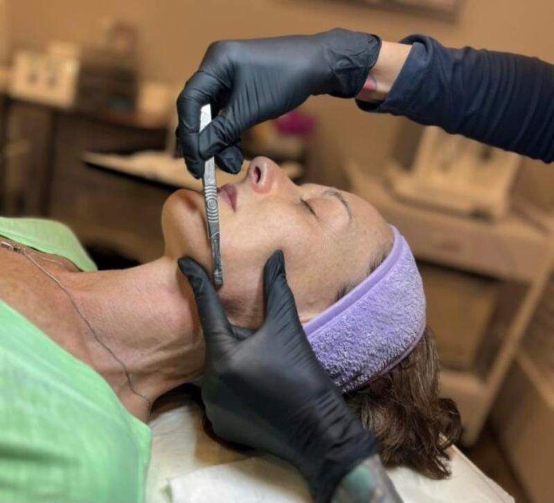 DermaPlane-1-e1735239885209