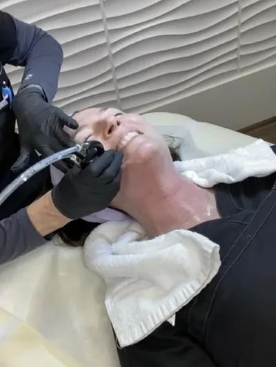 HydraFacial